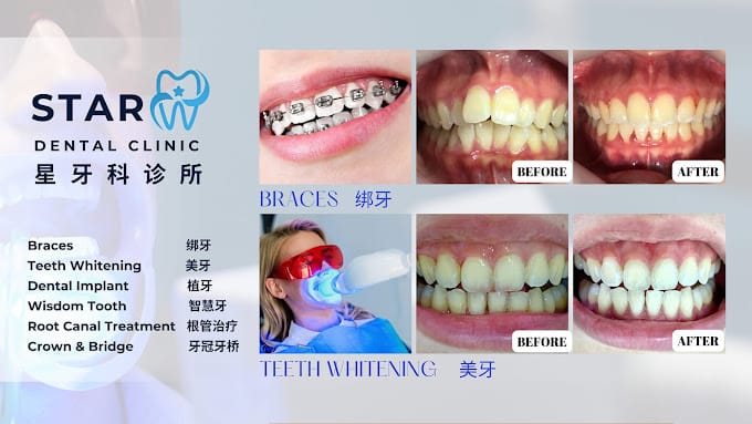 Star Dental Clinic Bukit Mertajam 星牙科 -Implant & Braces Centre