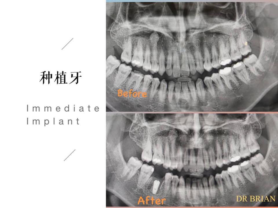 Dentessence Dental Clinic (Dr Brian’s Smile28)