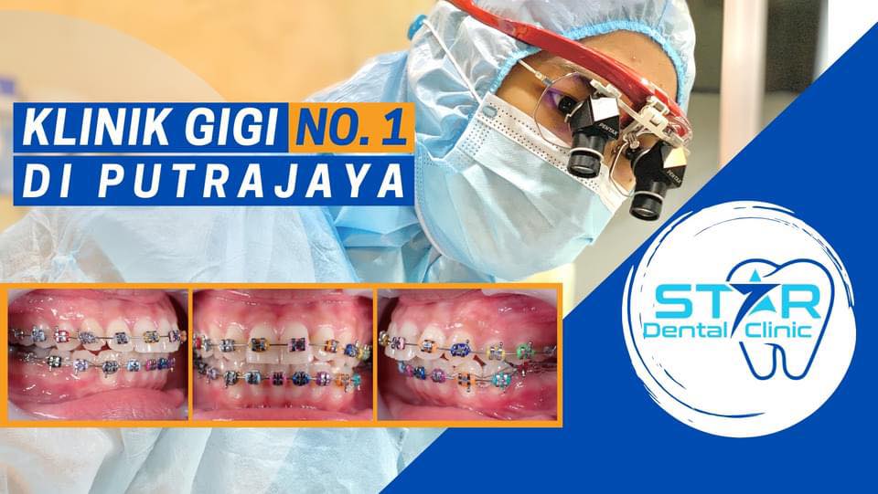 Klinik Pergigian Star (Dentist Putrajaya)